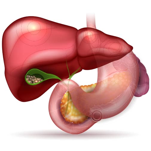 7-Gall-and-bile-duct-stones